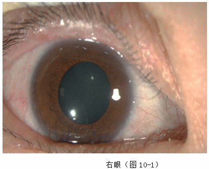 ZY016_46_2.gif
